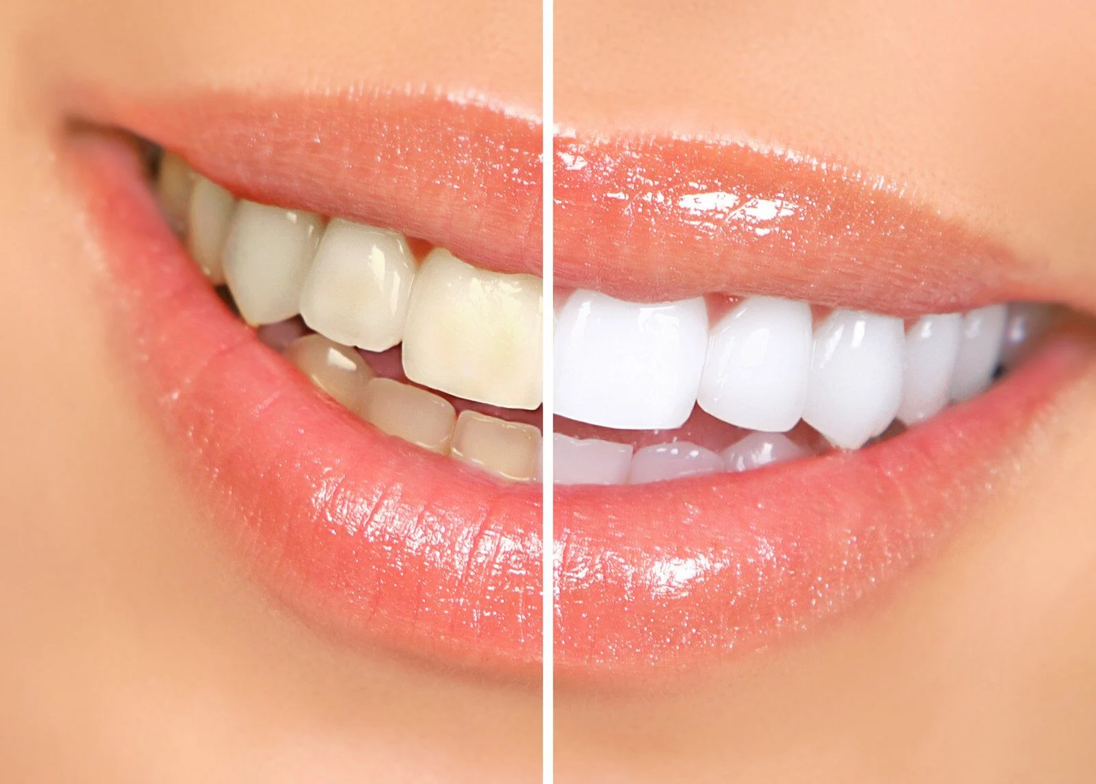 Cosmetic Dentistry for Stained Teeth: Best Treatment Options