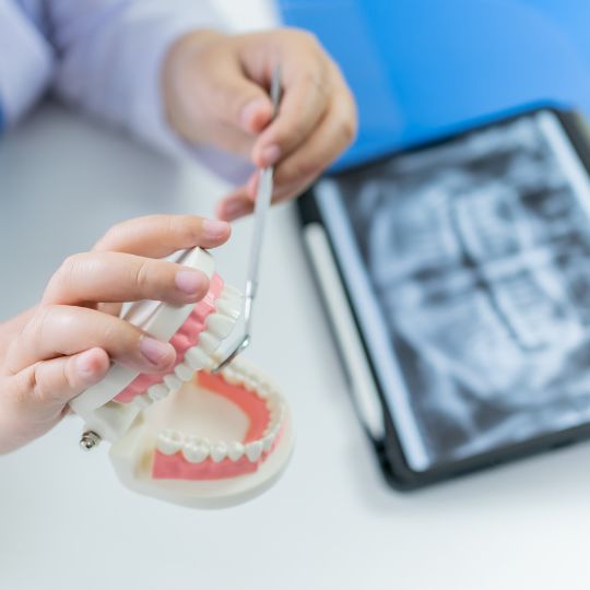 18-1st-July-Dental-Implants-and-Smoking-GuildfordBlog.jpg